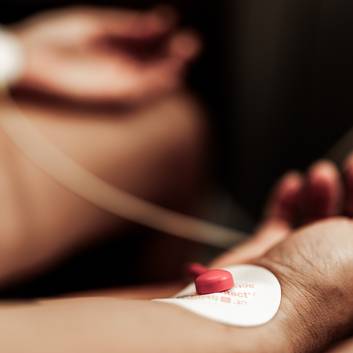 Elektroden von der HRV Kurzzeitmessung via Cardioscan